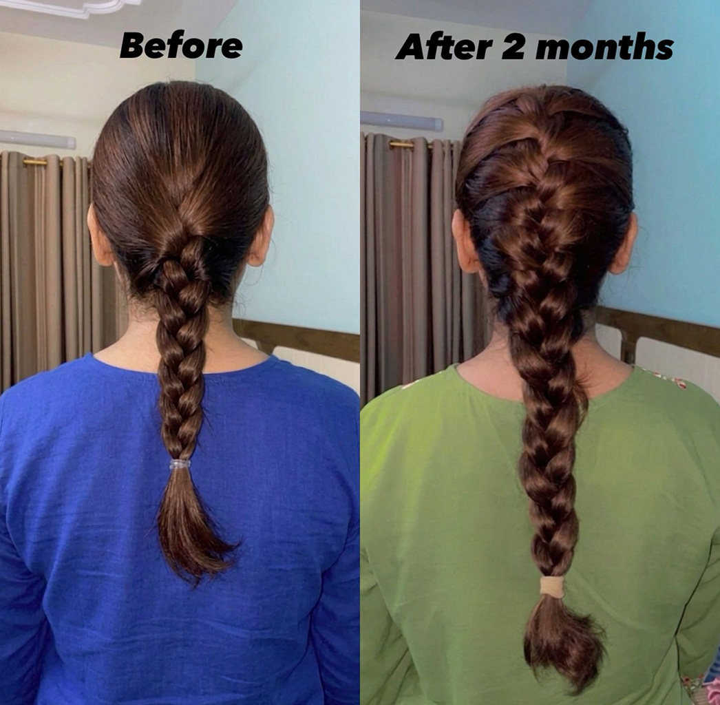 Hair result before and after thumbnail
